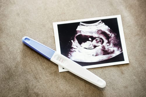 Ohio GOP bill would create state registry of pregnancies, require fetal death certificates