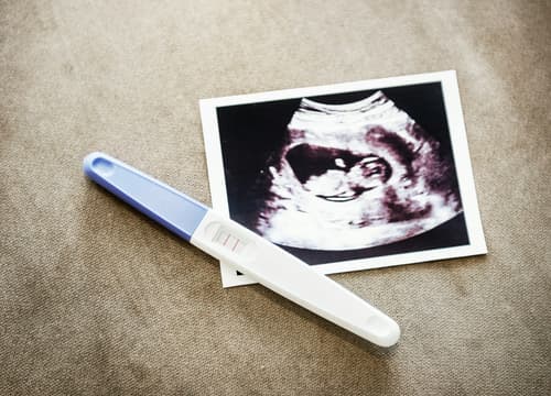 Ohio GOP bill would create state registry of pregnancies, require fetal death certificates